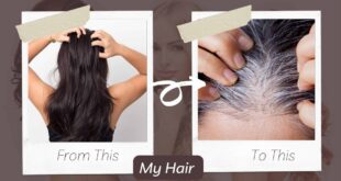 know the cause of white hairs and how to prevent them