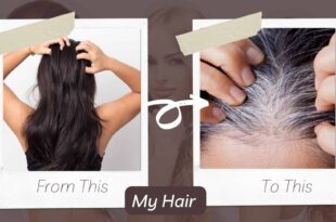 know the cause of white hairs and how to prevent them