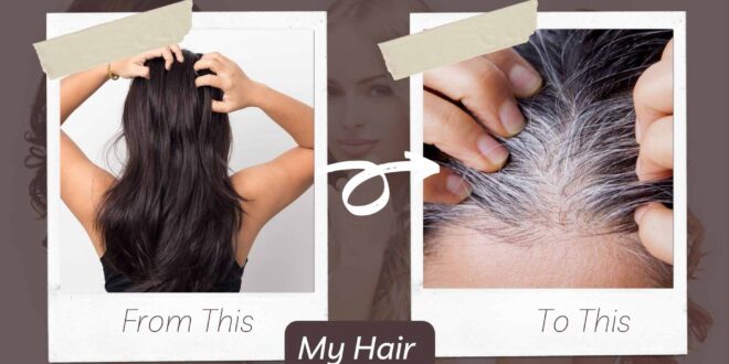 know the cause of white hairs and how to prevent them